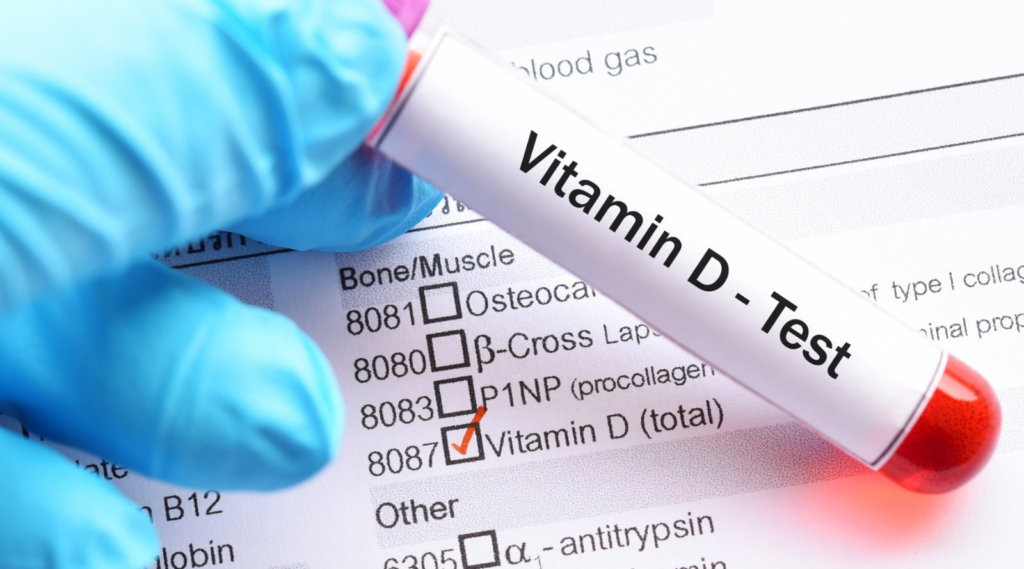 Vitamin D Blood Tests