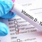 Vitamin D Blood Tests